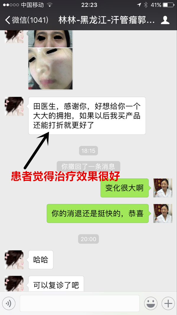 深圳茉莉皮肤与汗管瘤朋友的聊天记录