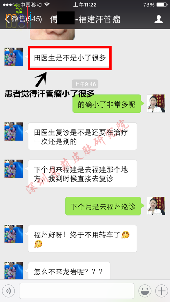深圳茉莉皮肤与汗管瘤朋友的聊天记录