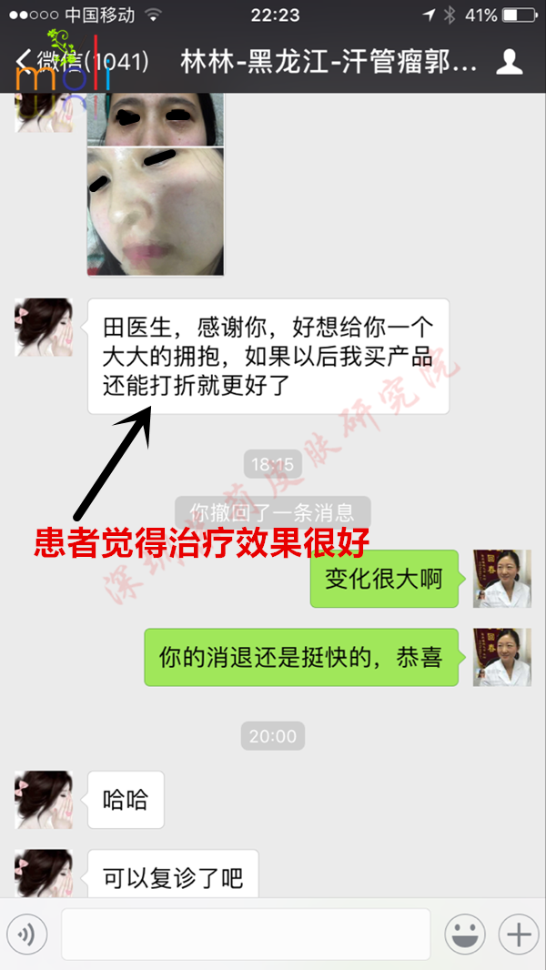 深圳茉莉皮肤与汗管瘤朋友的聊天记录