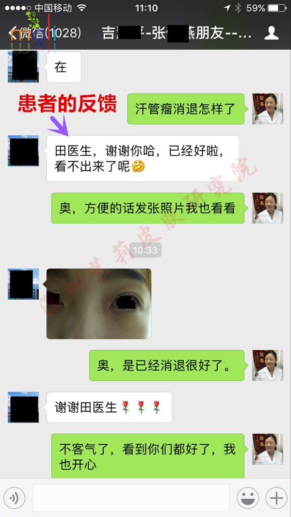 深圳茉莉皮肤与汗管瘤朋友的聊天记录