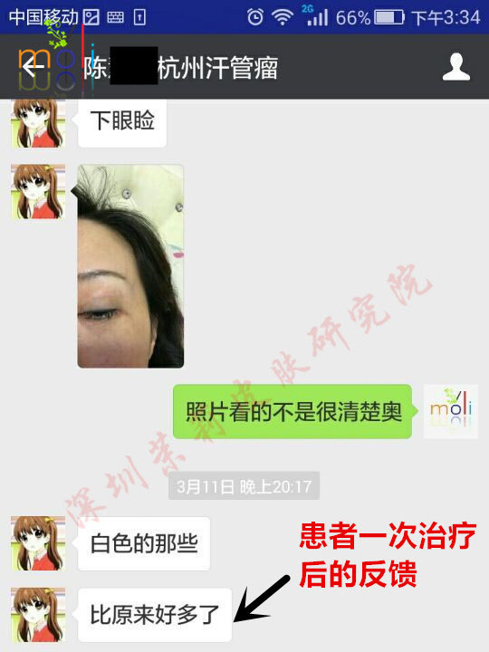 深圳茉莉皮肤与汗管瘤朋友的聊天记录