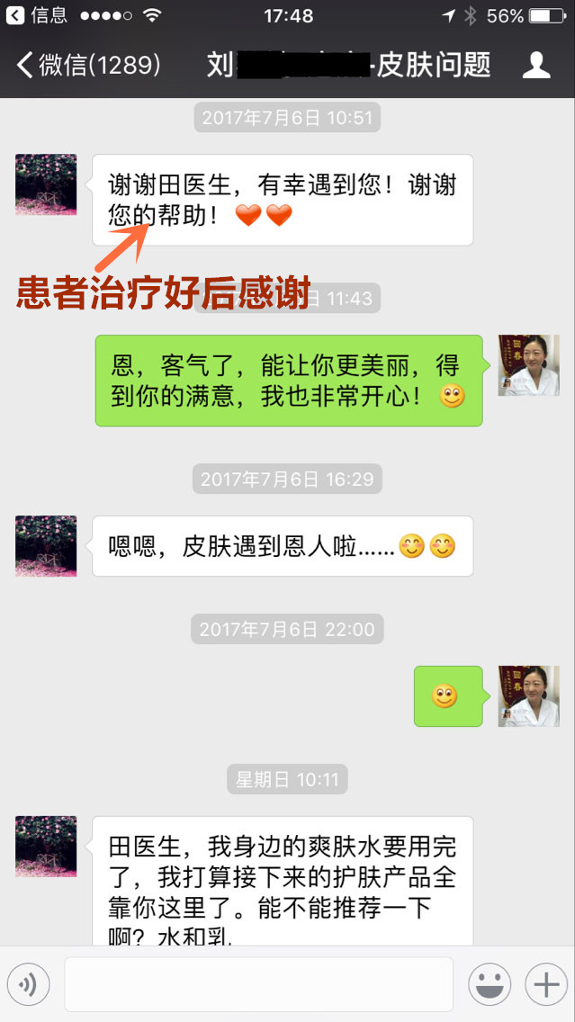 汗管瘤朋友的聊天记录