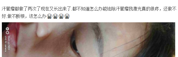 汗管瘤老是治不好?照她这样做,满脸汗管瘤疙瘩也能治好(图8) 激光治疗汗管瘤