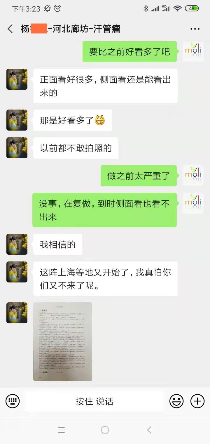 汗管瘤 汗管瘤